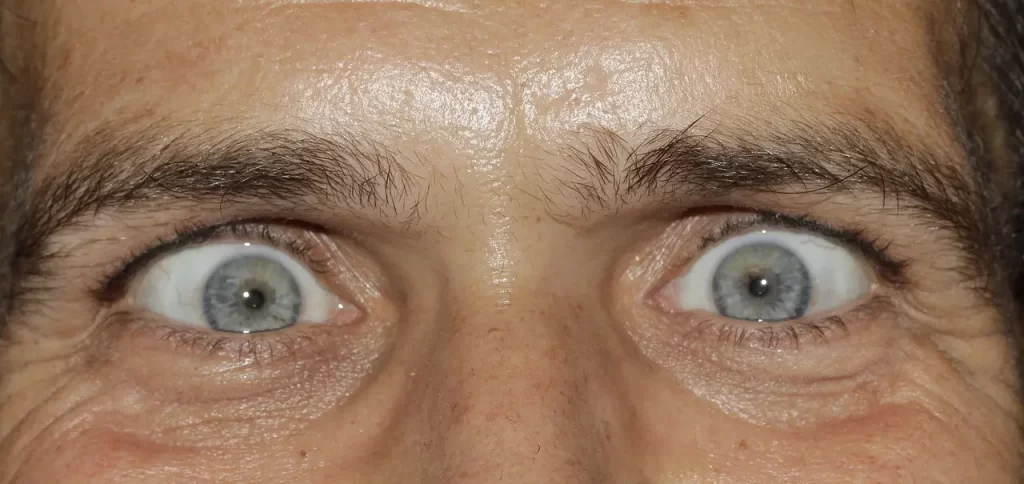 Ojos con locura
